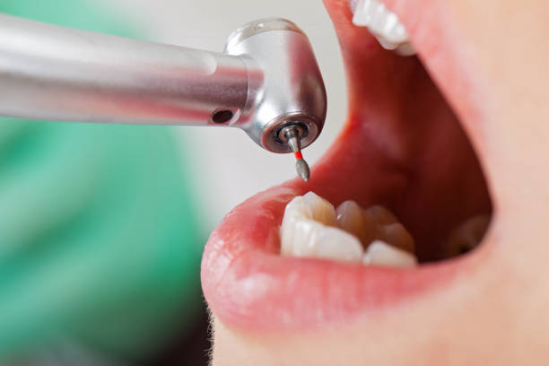 Best Emergency Pediatric Dentist  in Perryton, TX